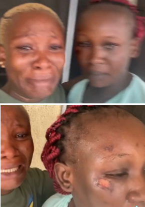 Please help us – Lady calls for public assistance over her sister who has suffered domestic violence for years (video)